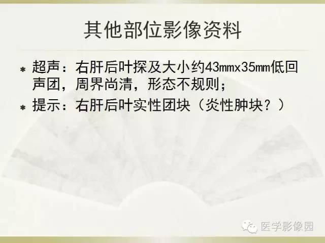 【病例】肝脏孤立性坏死结节1例CT及MR影像表现
