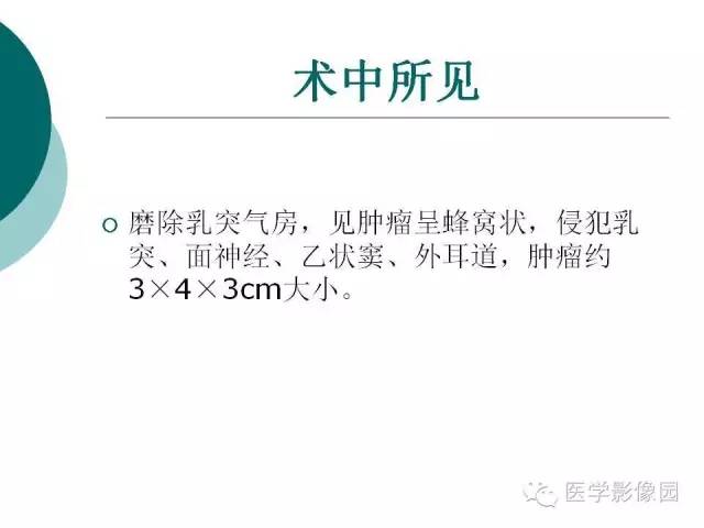 【病例】颞骨动脉瘤样骨囊肿1例CT及MR影像表现