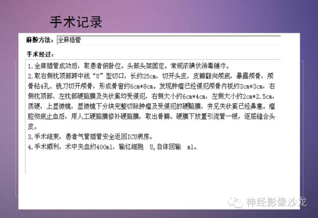 【病例】脑膜瘤1例CT及MR影像表现 【病例】脑膜瘤1例CT及MR影像表现