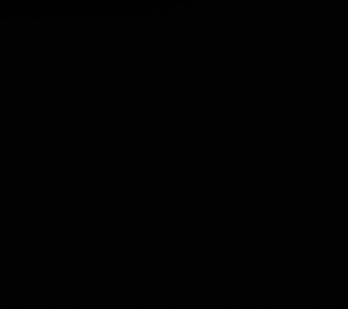 【病例】肱骨上段骨巨细胞瘤1例MR影像表现 【病例】肱骨上段骨巨细胞瘤1例MR影像表现
