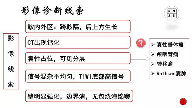 【病例】颅咽管瘤1例CT及MR影像表现
