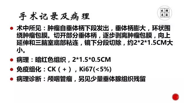 【病例】颅咽管瘤1例CT及MR影像表现