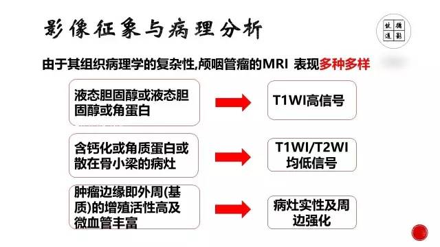 【病例】颅咽管瘤1例CT及MR影像表现