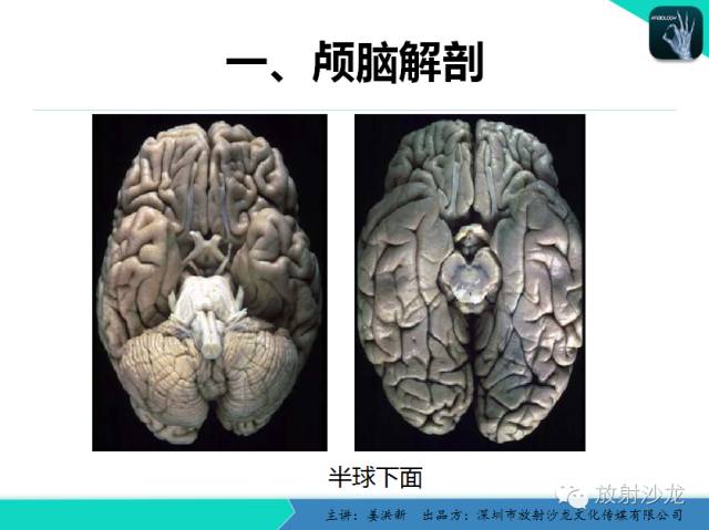 【PPT】高清分辨、精准定位、精准诊断、精准医疗的脑血管疾病应用研究