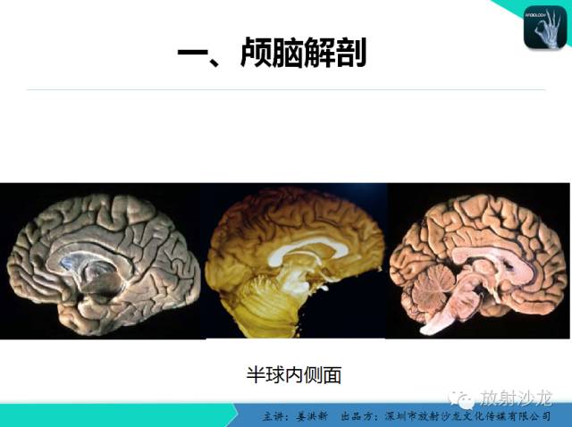 【PPT】高清分辨、精准定位、精准诊断、精准医疗的脑血管疾病应用研究