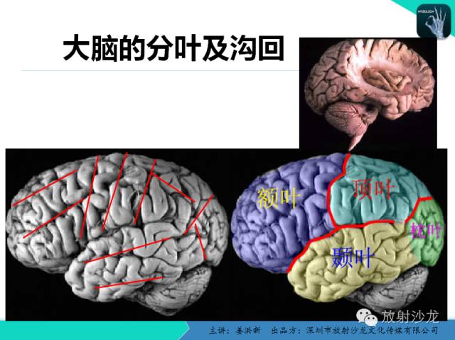【PPT】高清分辨、精准定位、精准诊断、精准医疗的脑血管疾病应用研究