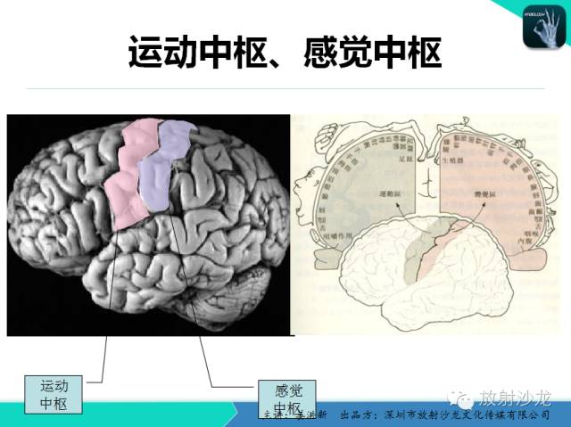 【PPT】高清分辨、精准定位、精准诊断、精准医疗的脑血管疾病应用研究