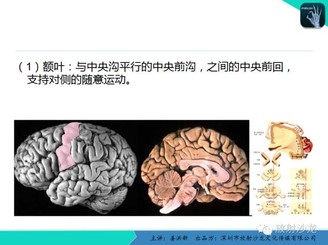 【PPT】高清分辨、精准定位、精准诊断、精准医疗的脑血管疾病应用研究