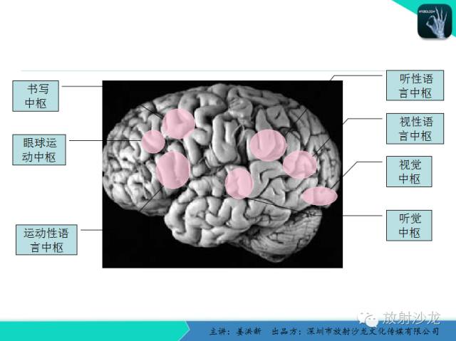 【PPT】高清分辨、精准定位、精准诊断、精准医疗的脑血管疾病应用研究