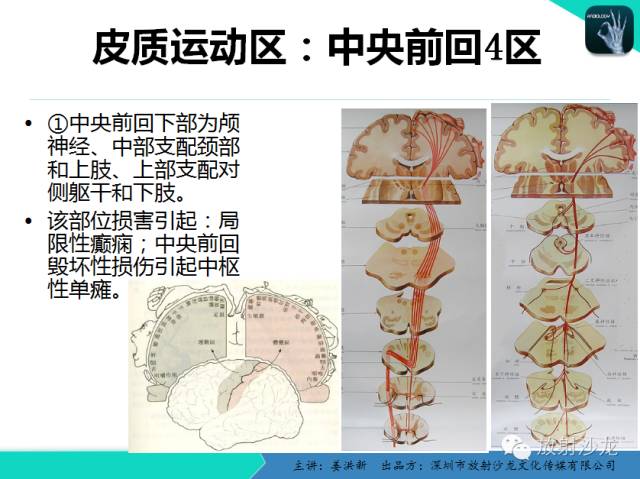【PPT】高清分辨、精准定位、精准诊断、精准医疗的脑血管疾病应用研究