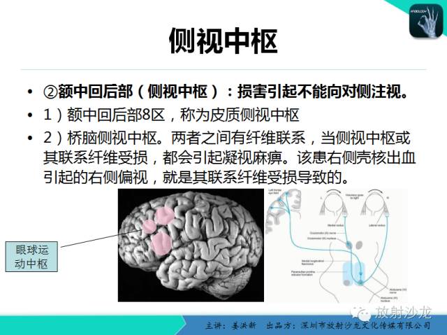 【PPT】高清分辨、精准定位、精准诊断、精准医疗的脑血管疾病应用研究