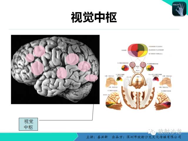 【PPT】高清分辨、精准定位、精准诊断、精准医疗的脑血管疾病应用研究