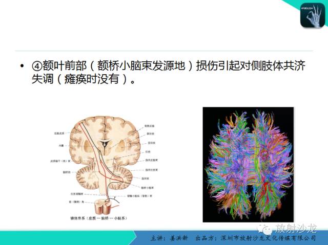 【PPT】高清分辨、精准定位、精准诊断、精准医疗的脑血管疾病应用研究