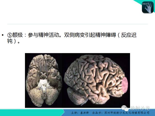 【PPT】高清分辨、精准定位、精准诊断、精准医疗的脑血管疾病应用研究