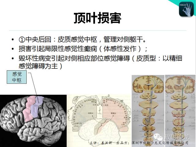【PPT】高清分辨、精准定位、精准诊断、精准医疗的脑血管疾病应用研究