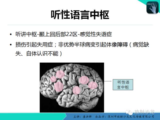 【PPT】高清分辨、精准定位、精准诊断、精准医疗的脑血管疾病应用研究