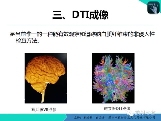 【PPT】高清分辨、精准定位、精准诊断、精准医疗的脑血管疾病应用研究