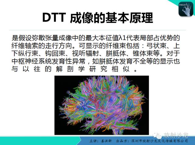 【PPT】高清分辨、精准定位、精准诊断、精准医疗的脑血管疾病应用研究