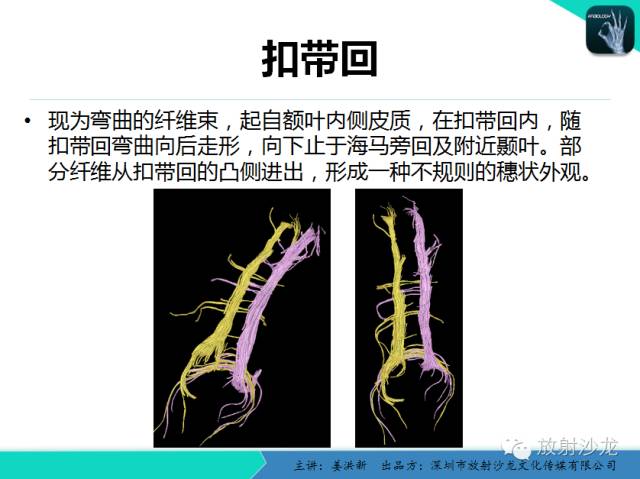 【PPT】高清分辨、精准定位、精准诊断、精准医疗的脑血管疾病应用研究