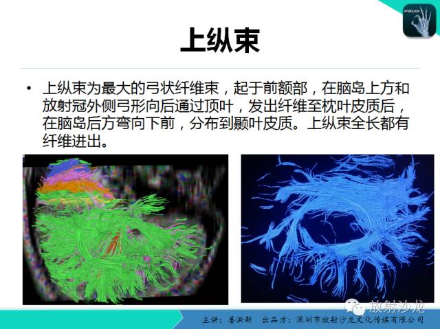 【PPT】高清分辨、精准定位、精准诊断、精准医疗的脑血管疾病应用研究