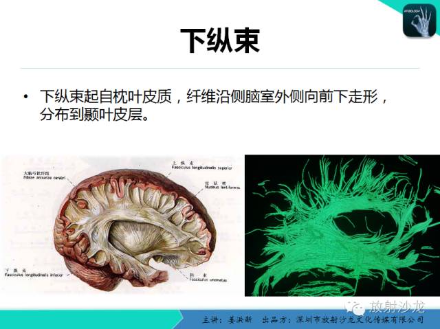 【PPT】高清分辨、精准定位、精准诊断、精准医疗的脑血管疾病应用研究