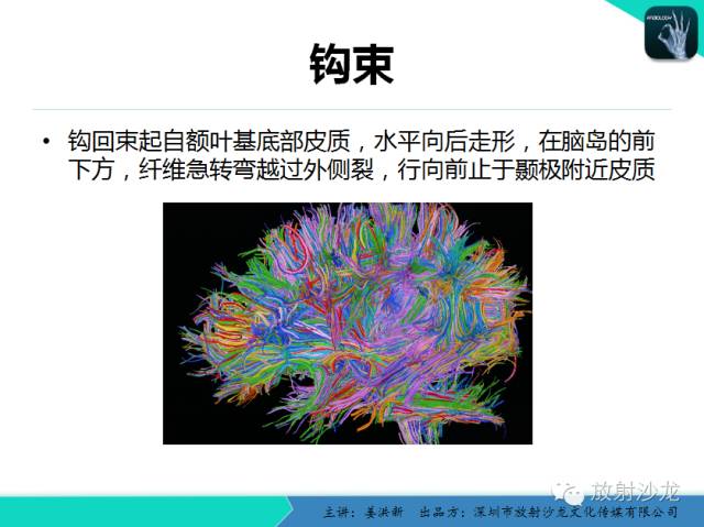【PPT】高清分辨、精准定位、精准诊断、精准医疗的脑血管疾病应用研究