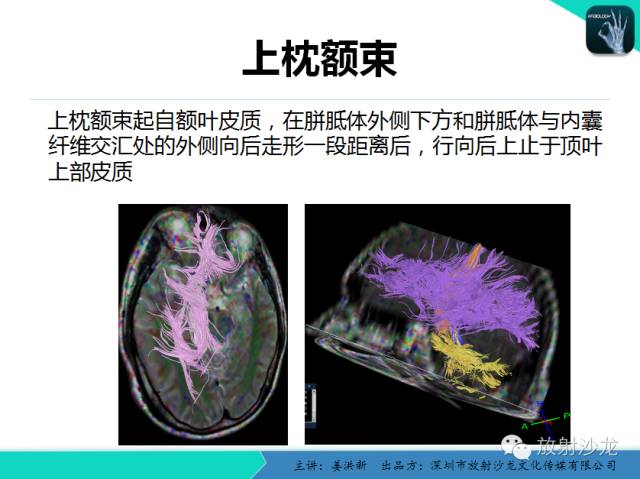 【PPT】高清分辨、精准定位、精准诊断、精准医疗的脑血管疾病应用研究