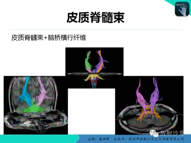 【PPT】高清分辨、精准定位、精准诊断、精准医疗的脑血管疾病应用研究