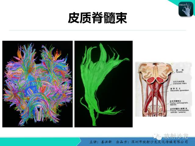 【PPT】高清分辨、精准定位、精准诊断、精准医疗的脑血管疾病应用研究