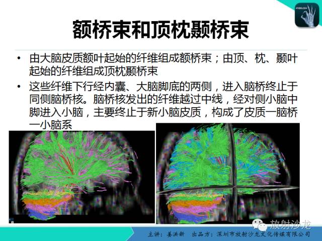 【PPT】高清分辨、精准定位、精准诊断、精准医疗的脑血管疾病应用研究