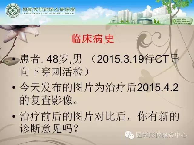 【病例】肺韦格氏肉芽肿1例CT影像表现