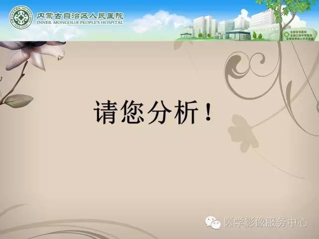 【病例】肺韦格氏肉芽肿1例CT影像表现