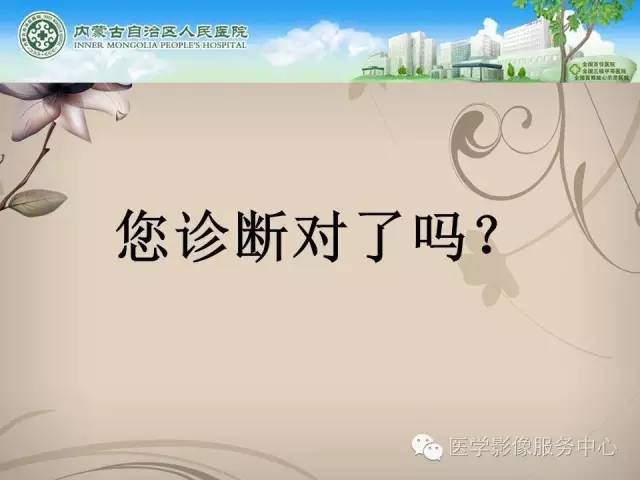 【病例】肺韦格氏肉芽肿1例CT影像表现