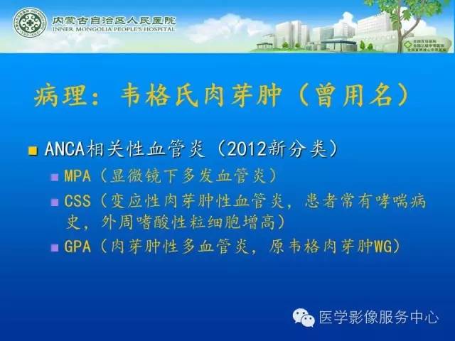 【病例】肺韦格氏肉芽肿1例CT影像表现