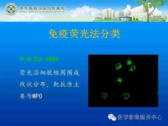 【病例】肺韦格氏肉芽肿1例CT影像表现