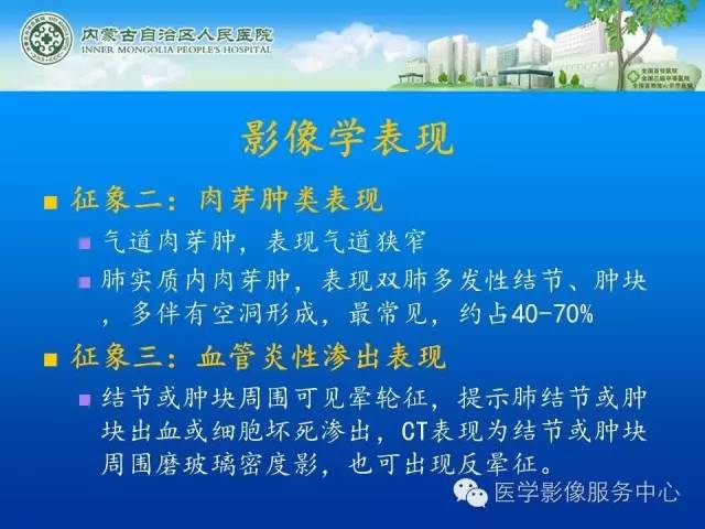 【病例】肺韦格氏肉芽肿1例CT影像表现