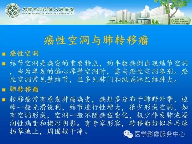 【病例】肺韦格氏肉芽肿1例CT影像表现