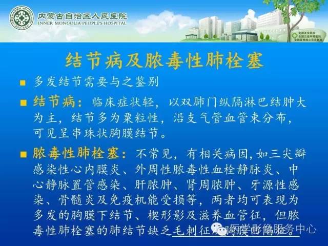 【病例】肺韦格氏肉芽肿1例CT影像表现