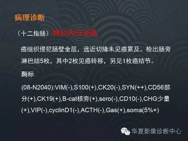 【病例】十二指肠神经内分泌肿瘤1例CT影像表现