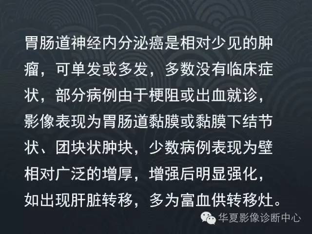 【病例】十二指肠神经内分泌肿瘤1例CT影像表现