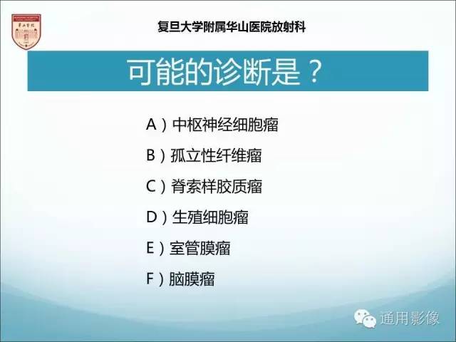 【病例】三脑室孤立性纤维瘤/血管外皮瘤1例MR影像表现