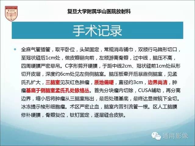 【病例】三脑室孤立性纤维瘤/血管外皮瘤1例MR影像表现