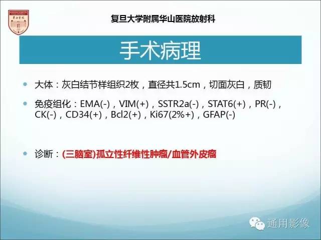 【病例】三脑室孤立性纤维瘤/血管外皮瘤1例MR影像表现