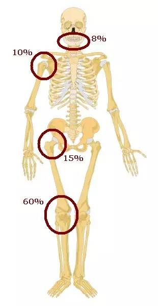 5 分钟学会:骨肉瘤的诊断要点 5 分钟学会:骨肉瘤的诊断要点