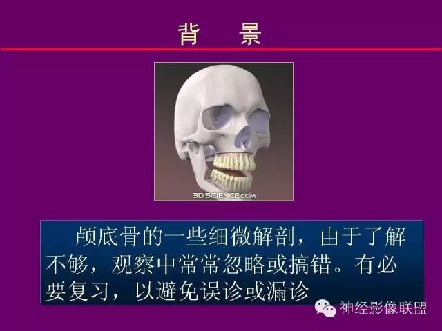 【PPT】颅底重要CT解剖及其临床意义