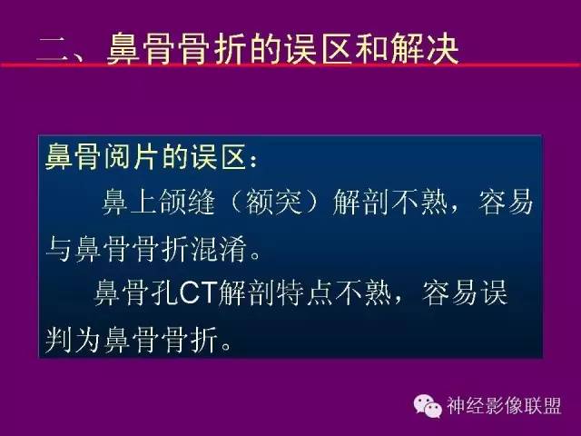 【PPT】颅底重要CT解剖及其临床意义