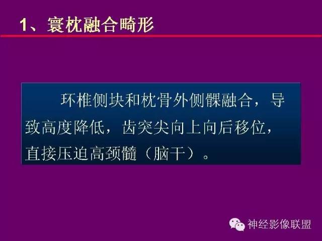 【PPT】颅底重要CT解剖及其临床意义