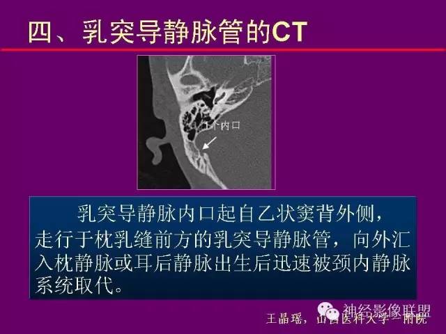 【PPT】颅底重要CT解剖及其临床意义