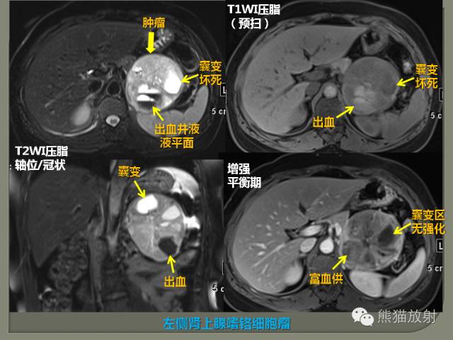 【PPT】如何简单理解、认识MRI图像