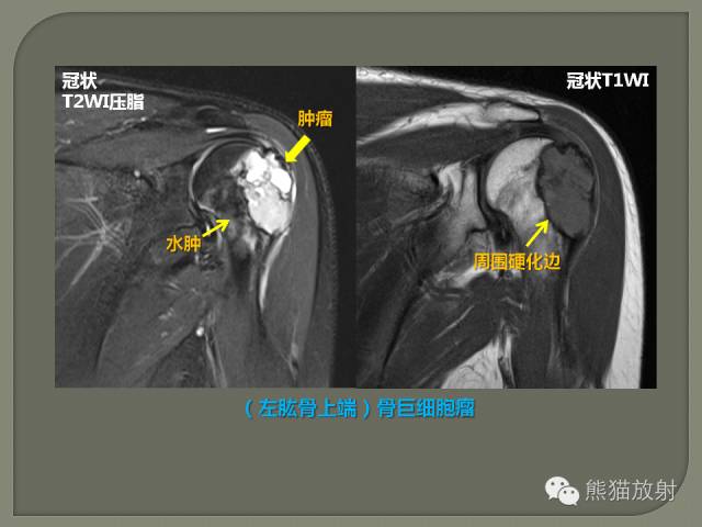 【PPT】如何简单理解、认识MRI图像